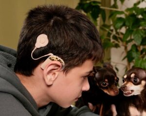 שתל שבלול כוכליארי Cochlear implant